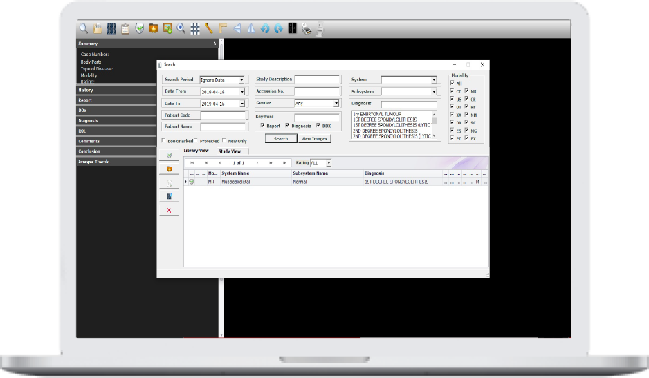 iCode Lite – Rosenfield